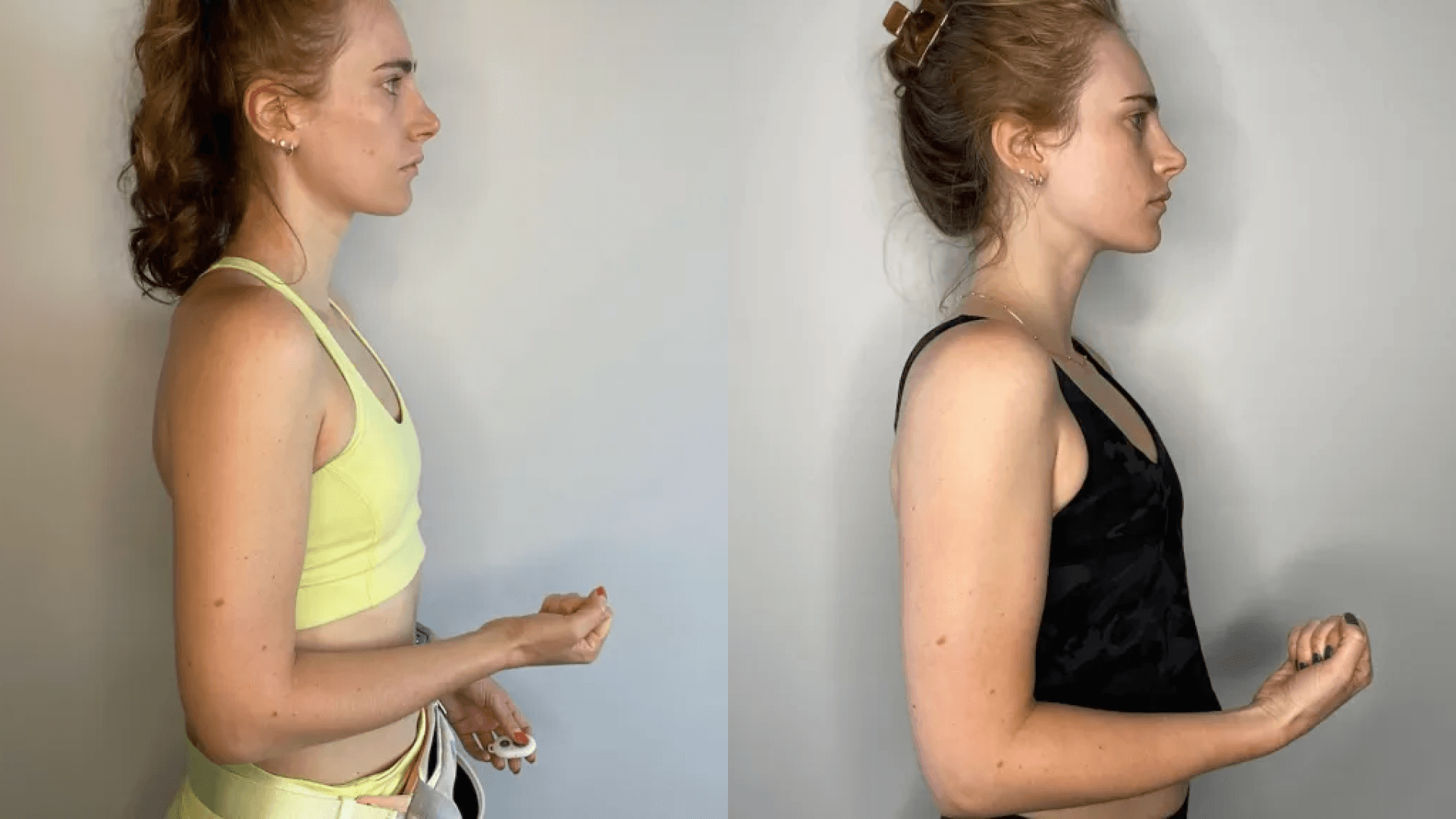 Bala Bangles Before / After 