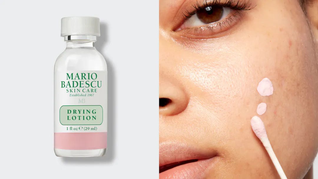 mario badescu pimple drying lotion