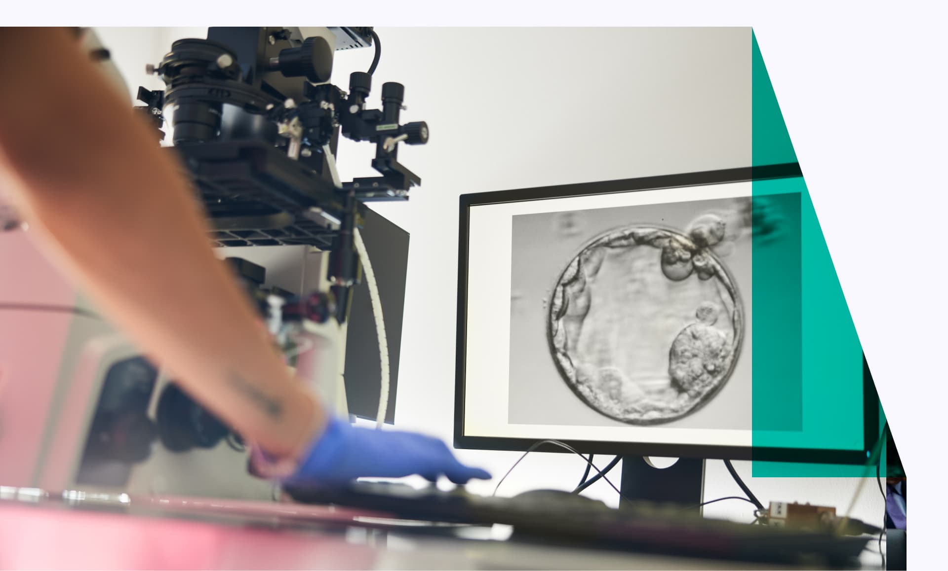 A fertility procedure is shown on the screen while a woman in scrubs follows the process in the lab.