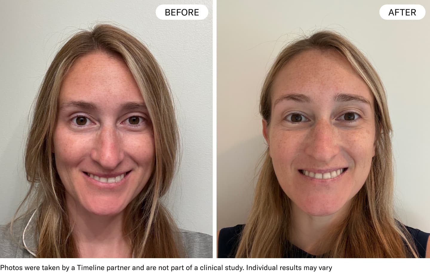 timeline before and after sarah