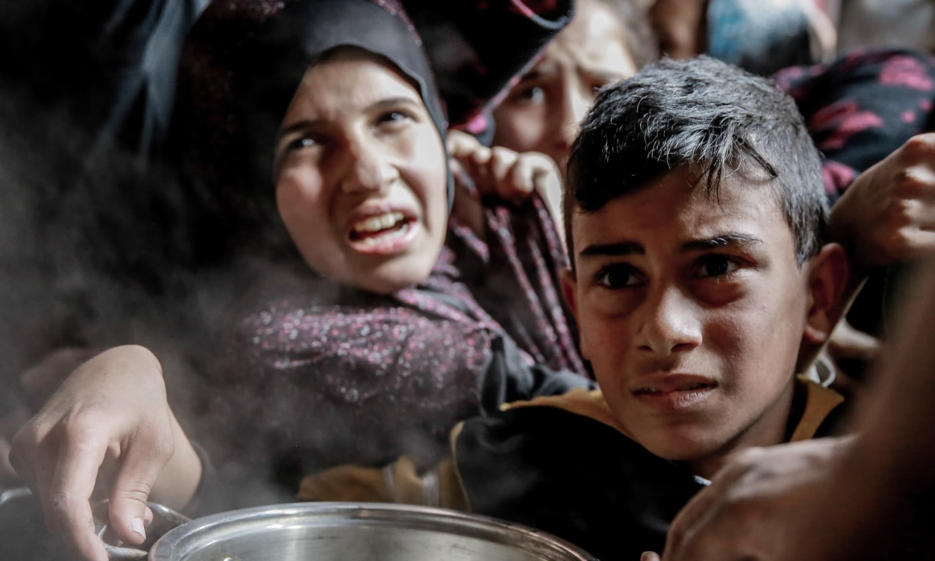 A starving child in Gaza