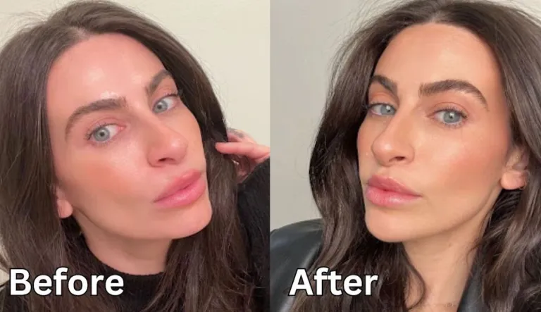 before and after photo