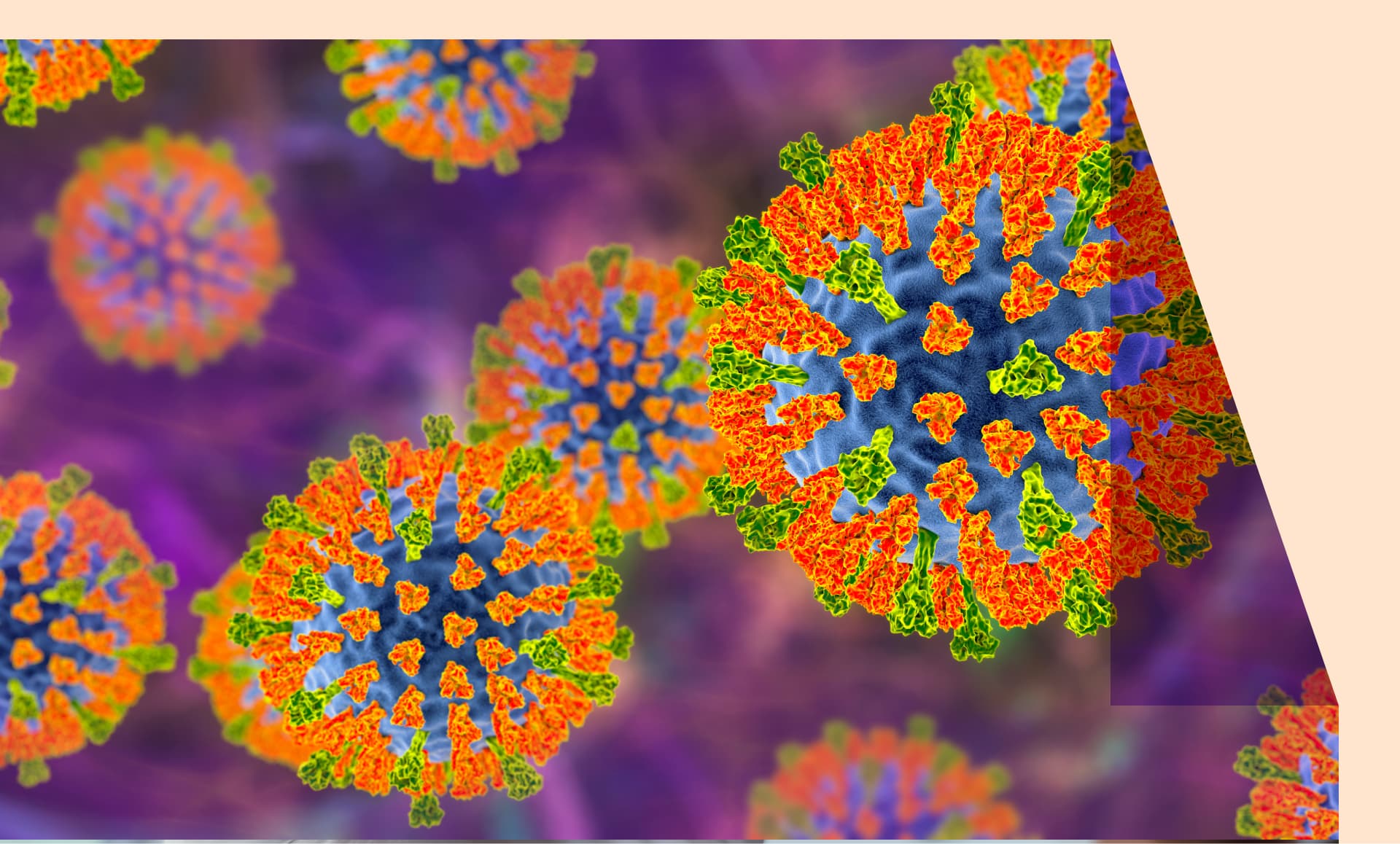 The US could lose its measles-elimination status in November.