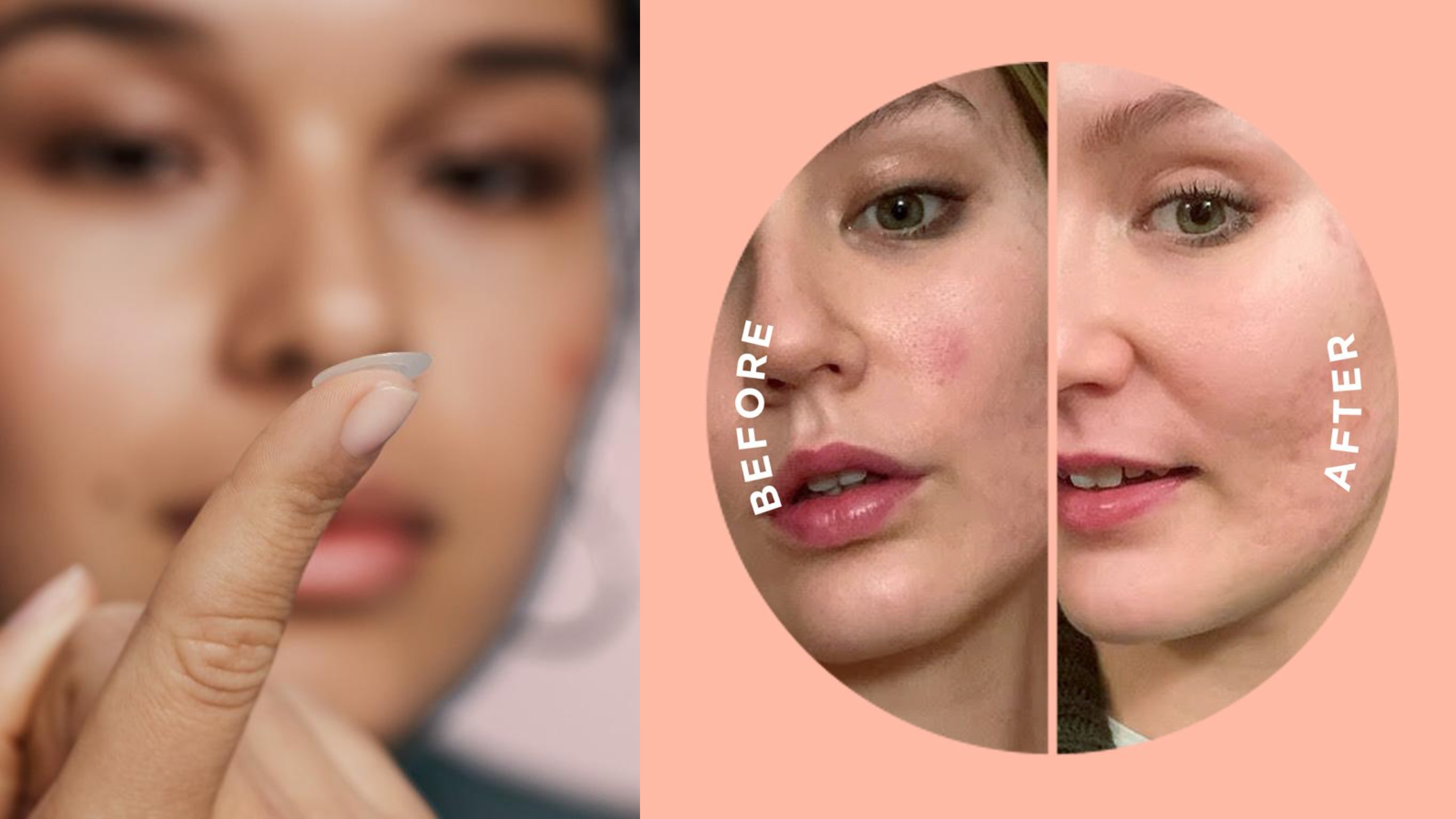 tiny patches to cover breakouts to help them heal faster