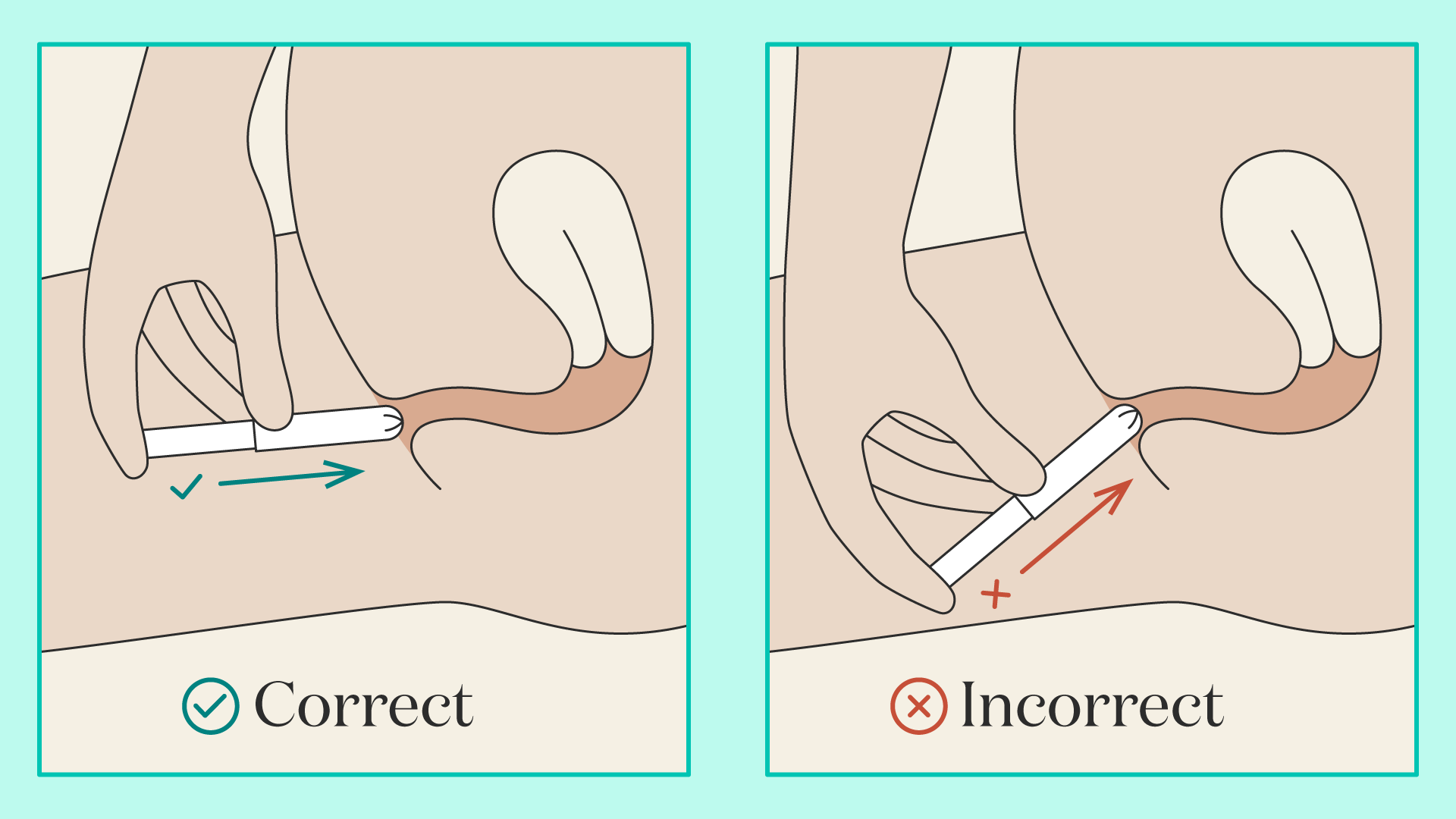 A diagram showing how to correctly insert a tampon