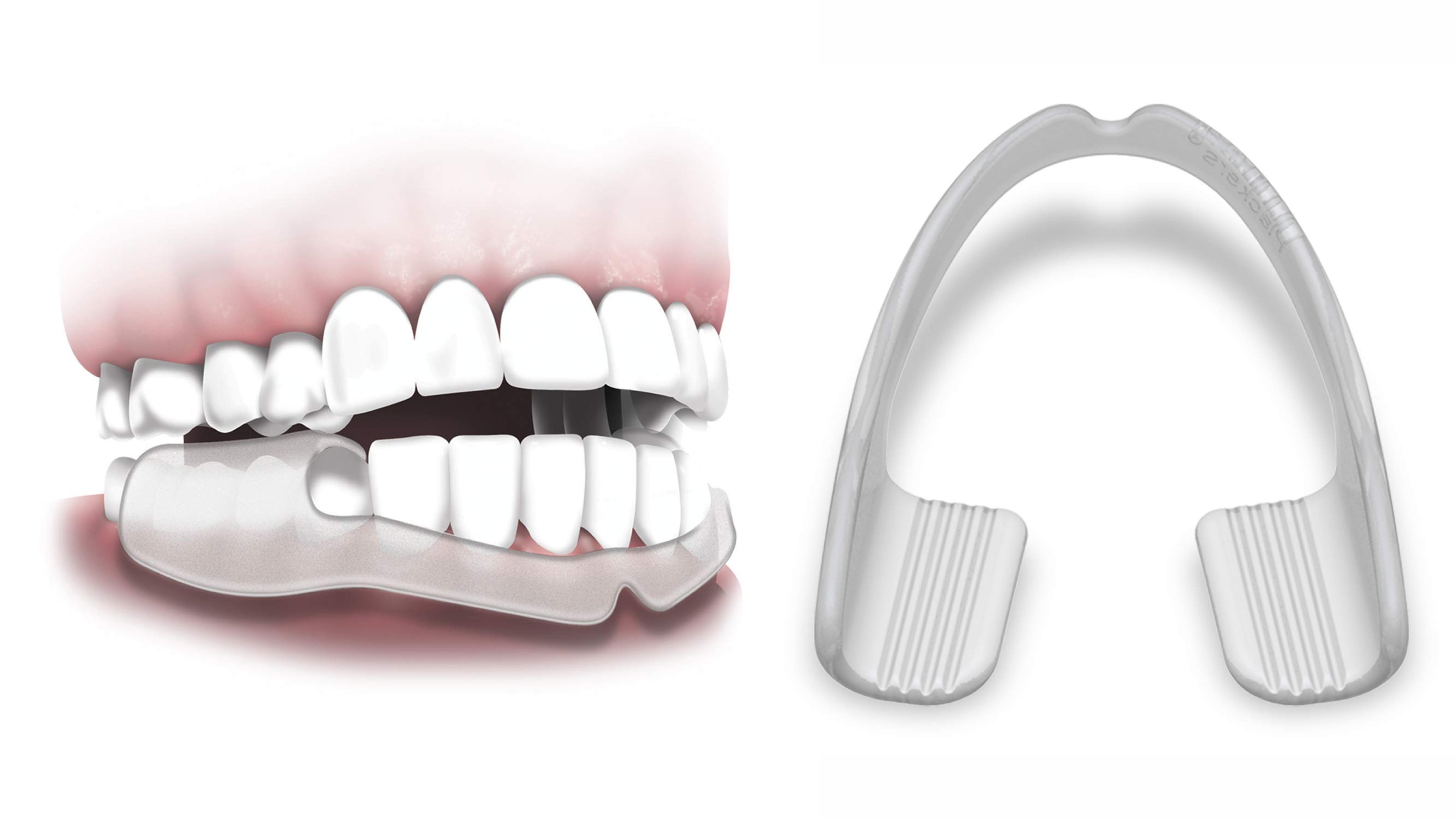 mouth guard to help with teeth grinding